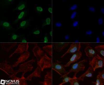 Immunocytochemistry/Immunofluorescence: Histone H3 [Dimethyl Lys4, p Thr6] Antibody [NB21-1038] - Antibody was tested at 1:10 in HeLa cells with DyLight 488 (green). Nuclei and alpha-tubulin were counterstained with DAPI (blue) and DyLight 550 (red). Image objective 40X.